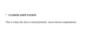 • CLOSED AMPUTATION
This is where the skin is closed primarily (most elective amputations).
 