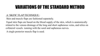 VARIATIONS OF THE STANDARD METHOD
A ‘SKEW’ FLAP TECHNIQUE :
Skin and muscle flaps are fashioned separately.
Equal skin flaps are based on the blood supply of the skin, which is anatomically
related to the venous drainage of the long and short saphenous veins, and relies on
collateral vessels running with the sural and saphenous nerves.
A single posterior muscle flap is used.
 