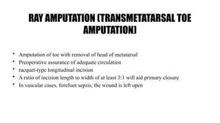 RAY AMPUTATION (TRANSMETATARSAL TOE
AMPUTATION)
• Amputation of toe with removal of head of metatarsal
• Preoperative assurance of adequate circulation
• racquet-type longitudinal incision
• A ratio of incision length to width of at least 3:1 will aid primary closure
• In vascular cases, forefoot sepsis, the wound is left open
 