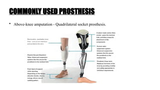COMMONLY USED PROSTHESIS
• Above-knee amputation - Quadrilateral socket prosthesis.
 