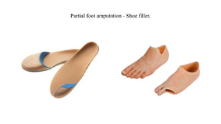 Partial foot amputation - Shoe filler.
 