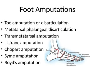 Foot Amputations
• Toe amputation or disarticulation
• Metatarsal phalangeal disarticulation
• Transmetatarsal amputation
• Lisfranc amputation
• Chopart amputation
• Syme amputation
• Boyd’s amputation
 