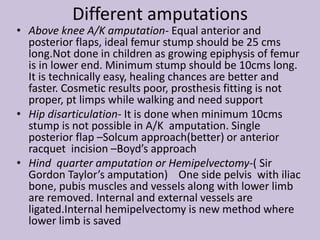Different amputations
• Krukenberg’s amputation- Done in upper limb
through forearm. A claw like gap is left between
radiu...