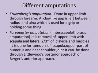 Levls of amputation (proper stump)
 