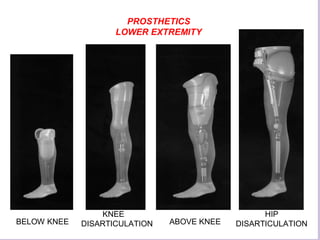 Lower limb prosthesis
• Jaipur foot- It is Indian modification for bare foot walking
made of vulcanized rubber and shaped ...
