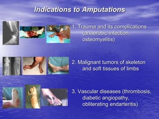Indications to Amputations
1. Trauma and its complications
(anaerobic infection,
osteomyelitis)
2. Malignant tumors of skeleton
and soft tissues of limbs
3. Vascular diseases (thrombosis,
diabetic angiopathy,
obliterating endarteritis)
 