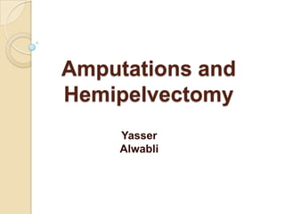 Amputations and
Hemipelvectomy
Yasser
Alwabli

 