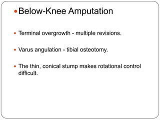  Midfoot amputations at the Lisfranc or Chopart
 level are usually traumatic;

 Conversion to a higher-level (Boyd or pe...