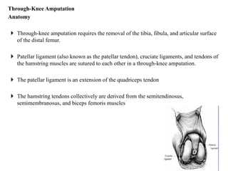 Amputations pdf | PDF