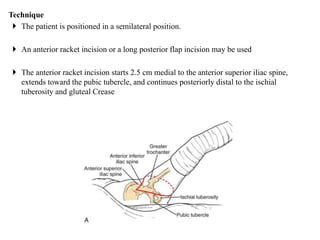 Dorsal Racket Incision Amputations pdf | PDF