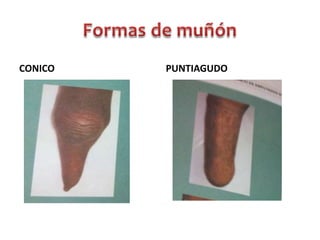 CONICO

PUNTIAGUDO

 