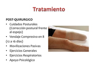 POST-QUIRURGICO
• Cuidados Posturales
(Corrección postural frente
al espejo)
• Vendaje Compresivo en 8
(12 a 16 días)
• Movilizaciones Pasivas
• Ejercicios Generales
• Ejercicios Respiratorios
• Apoyo Psicológico

 