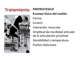 PREPROTESICO
Examen físico del muñón
Forma
Cicatriz
Valoración muscular
Amplitud de movilidad articular
de la articulación proximal
Sensibilidad y temperatura
Puntos dolorosos

 