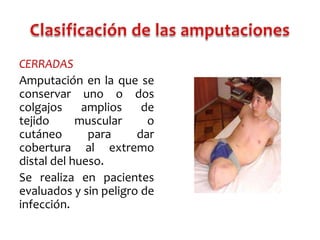 CERRADAS
Amputación en la que se
conservar uno o dos
colgajos
amplios
de
tejido
muscular
o
cutáneo
para
dar
cobertura al extremo
distal del hueso.
Se realiza en pacientes
evaluados y sin peligro de
infección.

 
