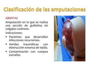 ABIERTAS
Amputación en la que se realiza
una sección de guillotina sin
colgajos cutáneos.
Indicaciones:
 Pacientes que desarrollan
infecciones recurrentes.
 Heridas traumáticas con
destrucción extensa de tejido.
 Contaminación con cuerpos
extraños

 