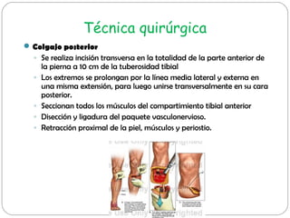 Técnica quirúrgica
Colgajo posterior
◦ Se realiza incisión transversa en la totalidad de la parte anterior de
la pierna a...
