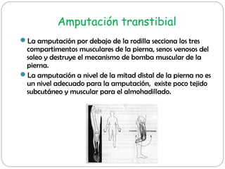 La amputación por debajo de la rodilla secciona los tres
compartimentos musculares de la pierna, senos venosos del
soleo ...