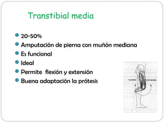 Transtibial media
20-50%
Amputación de pierna con muñón mediana
Es funcional
Ideal
Permite flexión y extensión
Buena...