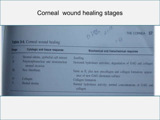 Corneal wound healing stages
 