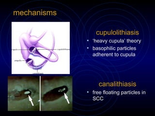 A Practical Approach to Assesment of Dizzy Patient | PPT