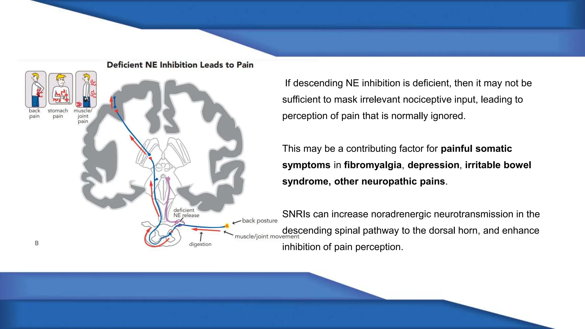 If descending NE inhibition is deficient, then it may not be
sufficient to mask irrelevant nociceptive input, leading to
perception of pain that is normally ignored.
This may be a contributing factor for painful somatic
symptoms in fibromyalgia, depression, irritable bowel
syndrome, other neuropathic pains.
SNRIs can increase noradrenergic neurotransmission in the
descending spinal pathway to the dorsal horn, and enhance
inhibition of pain perception.