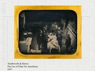 Southworth & Hawes
The Use of Ether for Anesthesia
1847
 