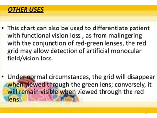13
OTHER USES
• This chart can also be used to differentiate patient
with functional vision loss , as from malingering
with the conjunction of red-green lenses, the red
grid may allow detection of artificial monocular
field/vision loss.
• Under normal circumstances, the grid will disappear
when viewed through the green lens; conversely, it
will remain visible when viewed through the red
lens.
 