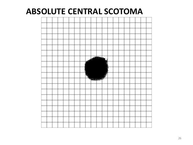amsler grid chart amsler chart types
