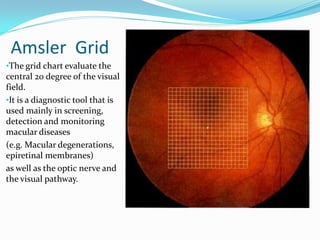 Amsler Test: A Brief Study On It's Practical Application