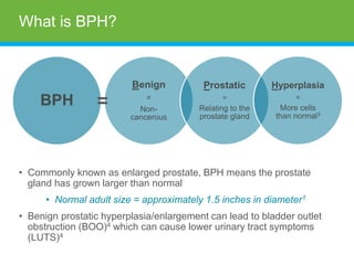 What is BPH?
• Commonly known as enlarged prostate, BPH means the prostate
gland has grown larger than normal
• Normal adult size = approximately 1.5 inches in diameter1
• Benign prostatic hyperplasia/enlargement can lead to bladder outlet
obstruction (BOO)4 which can cause lower urinary tract symptoms
(LUTS)4
BPH
Benign
=
Non-
cancerous
Prostatic
=
Relating to the
prostate gland
Hyperplasia
=
More cells
than normal3
=
 