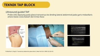 AMT TAP Block yang akan dijelaskan dalam beberapa slide | PPTX