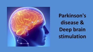Parkinson's
disease &
Deep brain
stimulation
 