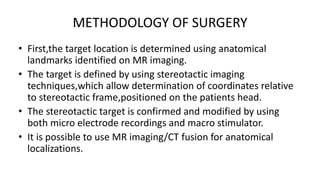 METHODOLOGY OF SURGERY
• First,the target location is determined using anatomical
landmarks identified on MR imaging.
• The target is defined by using stereotactic imaging
techniques,which allow determination of coordinates relative
to stereotactic frame,positioned on the patients head.
• The stereotactic target is confirmed and modified by using
both micro electrode recordings and macro stimulator.
• It is possible to use MR imaging/CT fusion for anatomical
localizations.
 