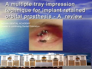 A multiple tray impressionA multiple tray impression
technique for implant retainedtechnique for implant retained
orbital prosthesis - A revieworbital prosthesis - A review
INDIAN DENTAL ACADEMY
Leader in continuing Dental Education
 