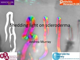 Andrea Murray
Shedding light on scleroderma
 