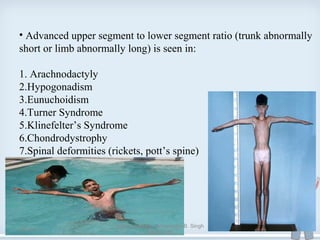 • Advanced upper segment to lower segment ratio (trunk abnormally
short or limb abnormally long) is seen in:
1. Arachnodactyly
2.Hypogonadism
3.Eunuchoidism
4.Turner Syndrome
5.Klinefelter’s Syndrome
6.Chondrodystrophy
7.Spinal deformities (rickets, pott’s spine)
08/24/13
Anthropometry - Amarendra B. Singh
090201263
35
 