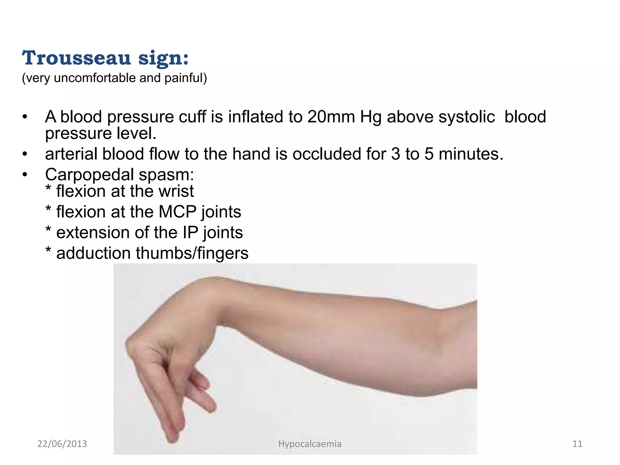 Trousseau sign:
(very uncomfortable and painful)
• A blood pressure cuff is inflated to 20mm Hg above systolic blood
pressure level.
• arterial blood flow to the hand is occluded for 3 to 5 minutes.
• Carpopedal spasm:
* flexion at the wrist
* flexion at the MCP joints
* extension of the IP joints
* adduction thumbs/fingers
22/06/2013 Hypocalcaemia 11
 
