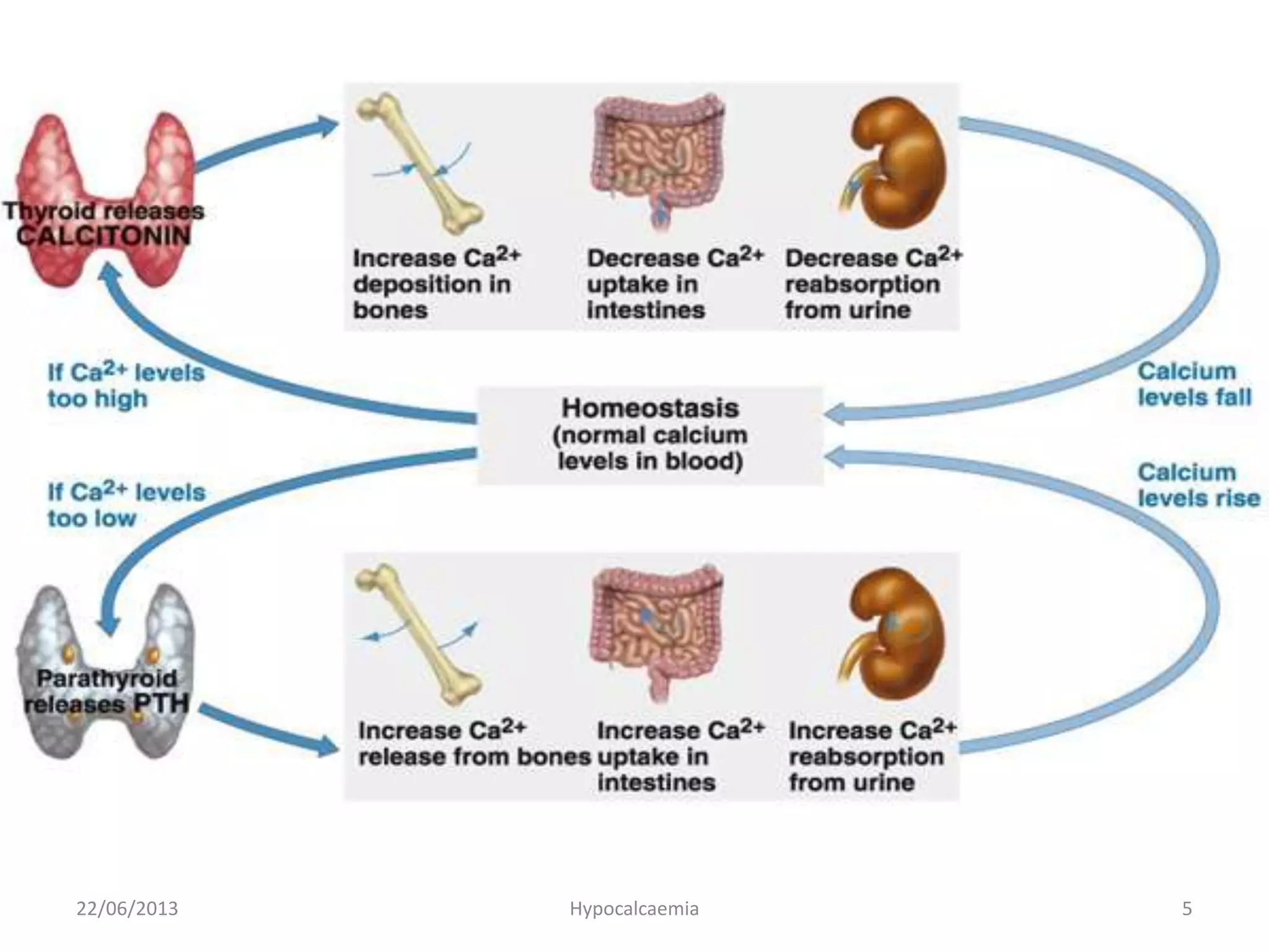22/06/2013 Hypocalcaemia 5
 