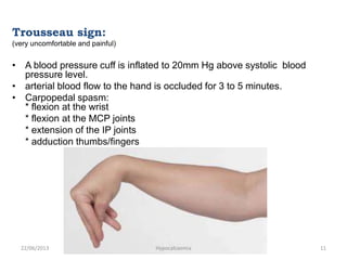 Trousseau sign:
(very uncomfortable and painful)
• A blood pressure cuff is inflated to 20mm Hg above systolic blood
pressure level.
• arterial blood flow to the hand is occluded for 3 to 5 minutes.
• Carpopedal spasm:
* flexion at the wrist
* flexion at the MCP joints
* extension of the IP joints
* adduction thumbs/fingers
22/06/2013 Hypocalcaemia 11
 