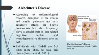 Alzheimer’s Disease
According to epidemiological
research, disruption of the insulin
and amylin pathways not only
adversely affects the body’s
homeostasis but also frequently
plays a crucial part in age-related
cognitive decline and
neurodegenerative diseases such as
AD.
Individuals with DM-II are 2-5
times more likely to have this
disease(Potenza et al., 2021).
Fig. 1.4: Alzheimer’s Disease
https://images.app.goo.gl/qaoKF1WFLr
HidzCz9
 
