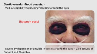 Amylodosis | PPTX