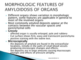  Different organs shows variation in morphologic
pattern, some features are applicable in general to
most of the involved organs
 Most commonly amyloid deposits appear at the
contacts between the vascular spaces and
parenchymal cells
 Grossly
◦ affected organ is usually enlarged, pale and rubbery
◦ Cut surface shows firm, waxy and translucent parenchyma
◦ positive staining with the iodine test.
 Microscopically
◦ the deposits of amyloid are found in the extracellular
locations, initially in the walls of small blood vessels
producing microscopic changes and effects,
◦ the deposits are in large amounts causing macroscopic
changes and effects of pressure atrophy.
www.dentaltutor.in
 