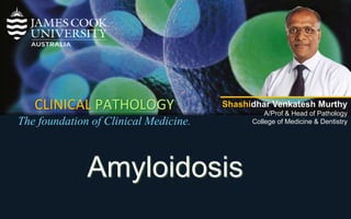 2
CLINICAL PATHOLOGY
The foundation of Clinical Medicine.
Shashidhar Venkatesh Murthy
A/Prof & Head of Pathology
College of Medicine & Dentistry
Amyloidosis
 