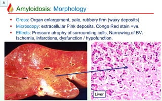 8
Amyloidosis: Morphology
 Gross: Organ enlargement, pale, rubbery firm (waxy deposits)
 Microscopy: extracellular Pink deposits. Congo Red stain +ve.
 Effects: Pressure atrophy of surrounding cells, Narrowing of BV.
Ischemia, infarctions, dysfunction / hypofunction.
Kidney
Liver
Normal
 