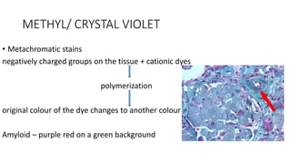 METHYL/ CRYSTAL VIOLET
• Metachromatic stains
negatively charged groups on the tissue + cationic dyes
polymerization
original colour of the dye changes to another colour
Amyloid – purple red on a green background
 