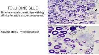 TOLUIDINE BLUE
Thiazine metachromatic dye with high
affinity for acidic tissue components.
Amyloid stains – weak basophilic
 