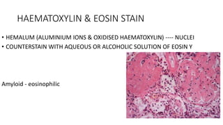 HAEMATOXYLIN & EOSIN STAIN
• HEMALUM (ALUMINIUM IONS & OXIDISED HAEMATOXYLIN) ---- NUCLEI
• COUNTERSTAIN WITH AQUEOUS OR ALCOHOLIC SOLUTION OF EOSIN Y
Amyloid - eosinophilic
 