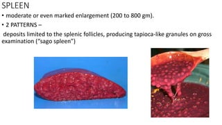 SPLEEN
• moderate or even marked enlargement (200 to 800 gm).
• 2 PATTERNS –
deposits limited to the splenic follicles, producing tapioca-like granules on gross
examination (“sago spleen”)
 