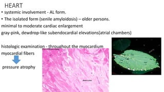 HEART
• systemic involvement - AL form.
• The isolated form (senile amyloidosis) – older persons.
minimal to moderate cardiac enlargement
gray-pink, dewdrop-like subendocardial elevations(atrial chambers)
histologic examination - throughout the myocardium
myocardial fibers
pressure atrophy
 