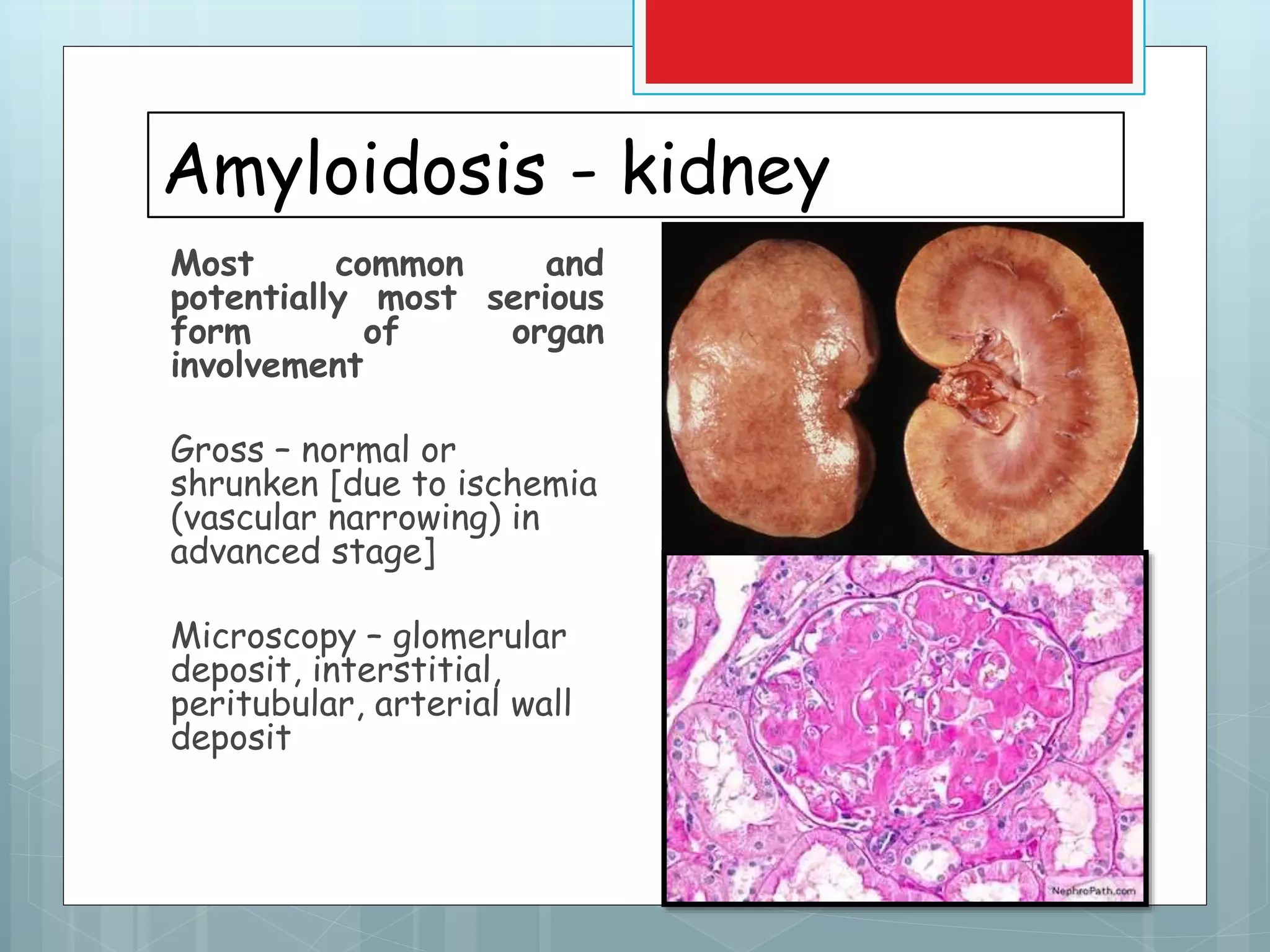 AMYLOIDOSIS | PPTX